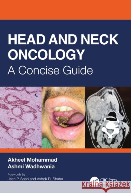 Head and Neck Oncology: A Concise Guide Mohammad Akheel Ashmi Wadhwania 9780367421311