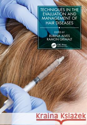 Techniques in the Evaluation and Management of Hair Diseases Grimalt, Ramon 9780367427894 CRC Press