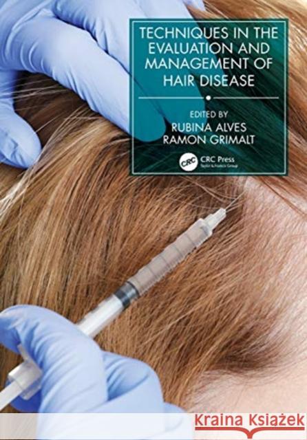 Techniques in the Evaluation and Management of Hair Diseases Grimalt, Ramon 9780367427900 CRC Press