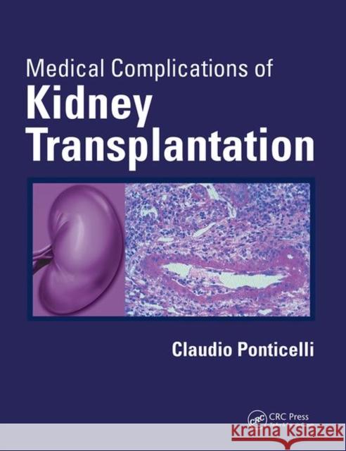 Medical Complications of Kidney Transplantation Claudio Ponticelli 9780367446215 CRC Press