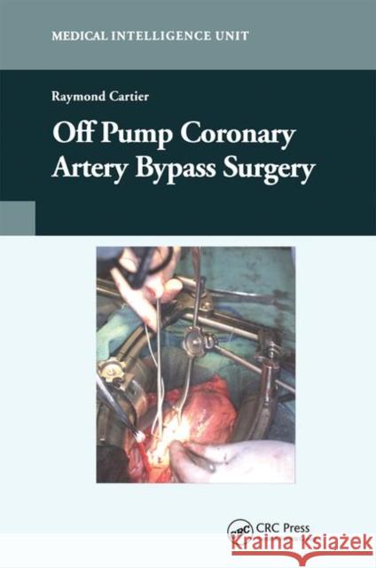 Off-Pump Coronary Artery Bypass Surgery Raymond Cartier   9780367446512 CRC Press