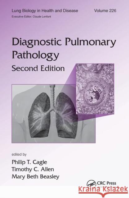 Diagnostic Pulmonary Pathology Philip T. Cagle Timothy C. Allen Mary Beth Beasley 9780367452636 CRC Press