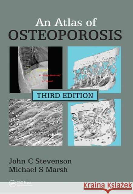 An Atlas of Osteoporosis John C. Stevenson, Michael S. Marsh 9780367452810 Taylor and Francis