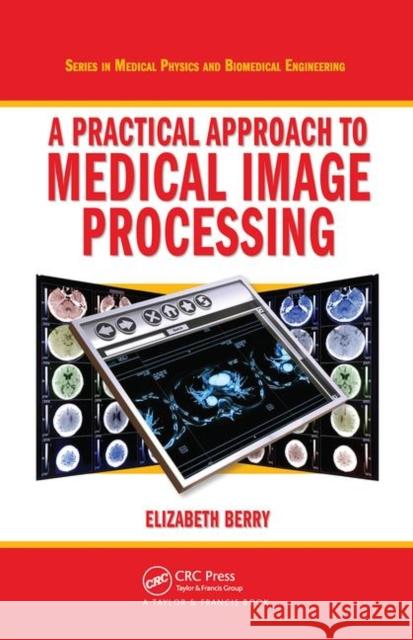 A Practical Approach to Medical Image Processing Elizabeth Berry (Elizabeth Berry Ltd, Le   9780367452841 CRC Press