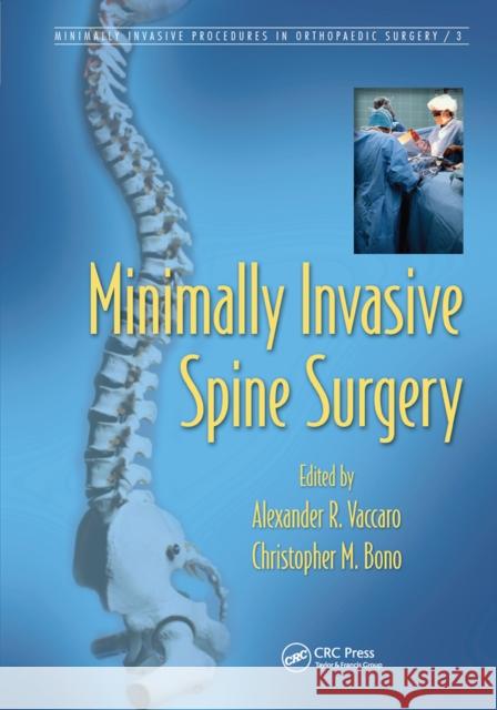 Minimally Invasive Spine Surgery Alexander R. Vaccaro Christopher M. Bono 9780367453060