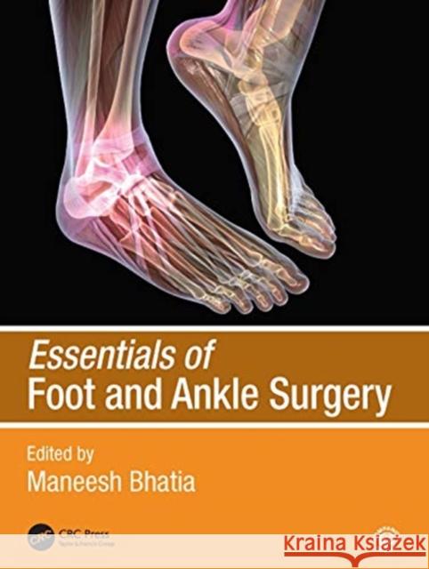 Essentials of Foot and Ankle Surgery Maneesh Bhatia 9780367464240 CRC Press