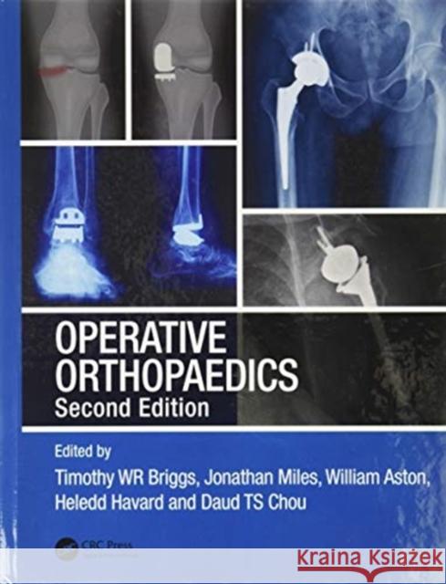 Operative Orthopaedics: The Stanmore Guide Miles, Jonathan 9780367470531 CRC Press