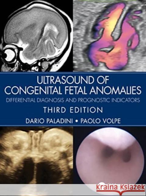 Ultrasound of Congenital Fetal Anomalies: Differential Diagnosis and Prognostic Indicators Dario Paladini Paolo Volpe 9780367499501 CRC Press