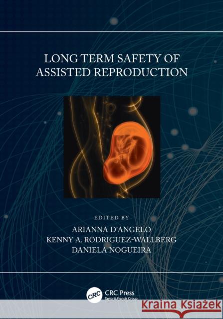 Long Term Safety of Assisted Reproduction Arianna D'Angelo Kenny A. Rodriguez-Wallberg Daniela Nogueira 9780367511203