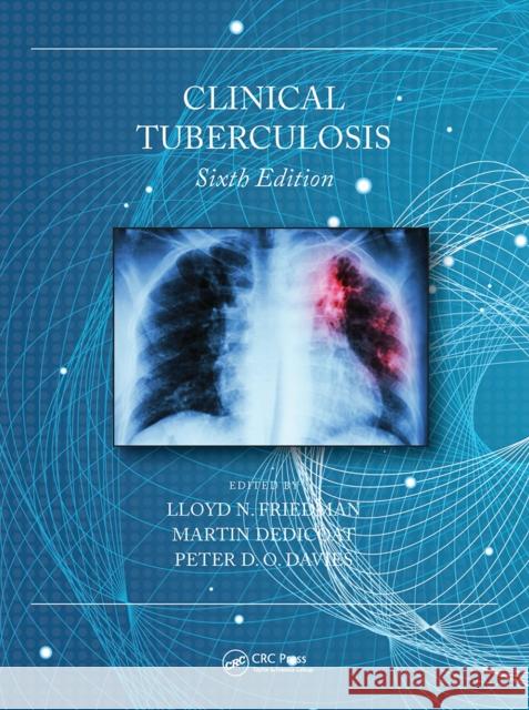 Clinical Tuberculosis  9780367529963 CRC Press