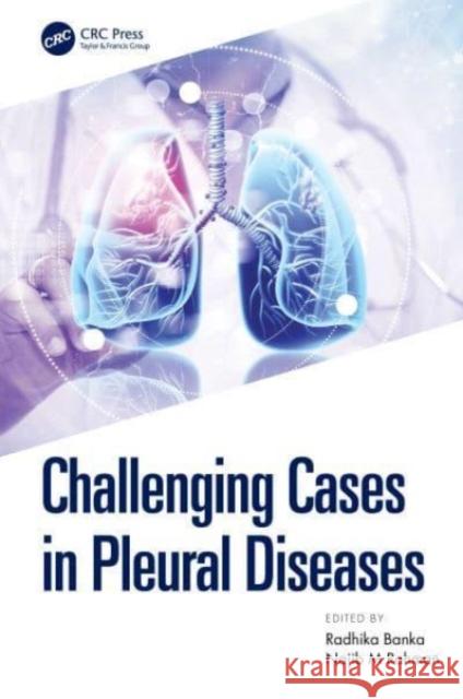 Challenging Cases in Pleural Diseases Najib Rahman Radhika Banka  9780367533717 CRC Press