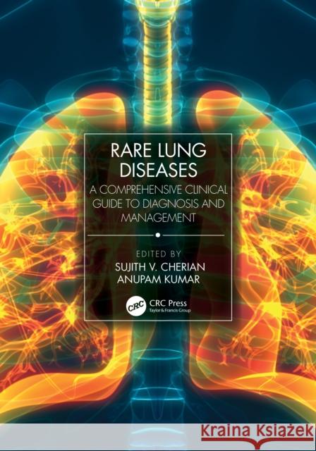 Rare Lung Diseases: A Comprehensive Clinical Guide to Diagnosis and Management Kumar, Anupam 9780367544553 Taylor & Francis Ltd