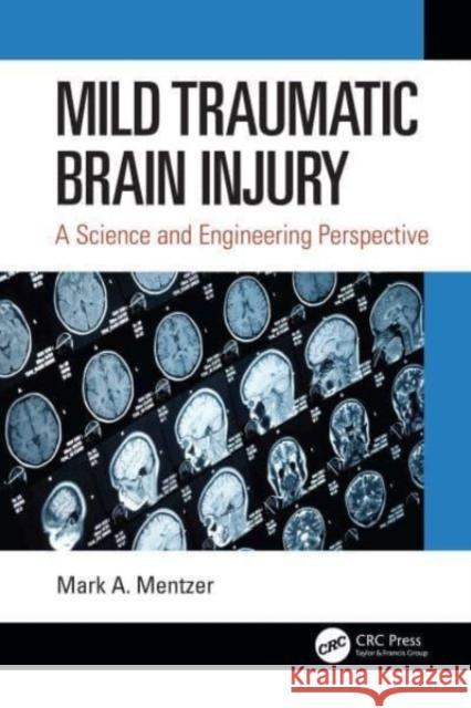 Mild Traumatic Brain Injury: A Science and Engineering Perspective Mark A. Mentzer (U.S. Army Research Labo   9780367567767 CRC Press