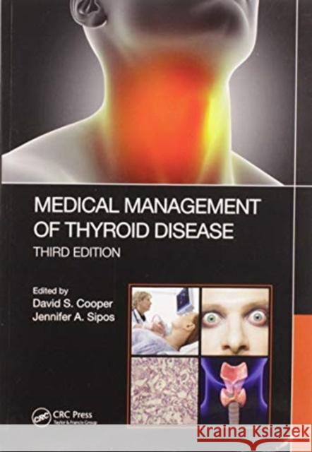 Medical Management of Thyroid Disease, Third Edition David S. Cooper Jennifer Sipos 9780367570637