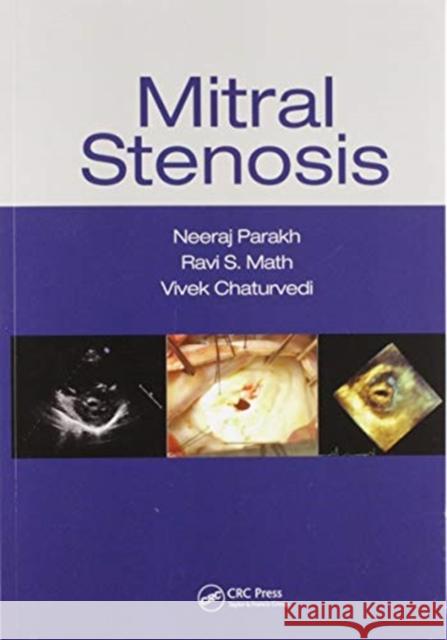 Mitral Stenosis Neeraj Parakh Ravi S. Math Vivek Chaturvedi 9780367571399