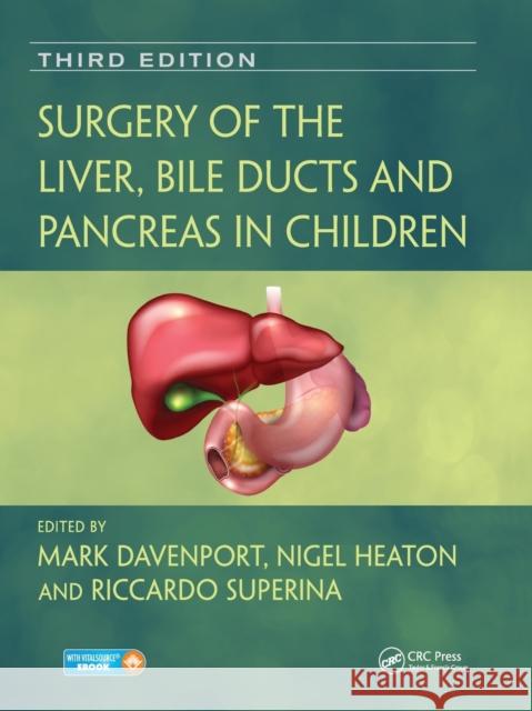 Surgery of the Liver, Bile Ducts and Pancreas in Children Mark Davenport Nigel Heaton Riccardo Superina 9780367573492 CRC Press