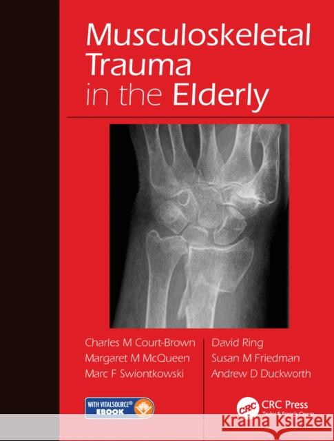 Musculoskeletal Trauma in the Elderly Charles Court-Brown Margaret McQueen Marc F. Swiontkowski 9780367574659 CRC Press