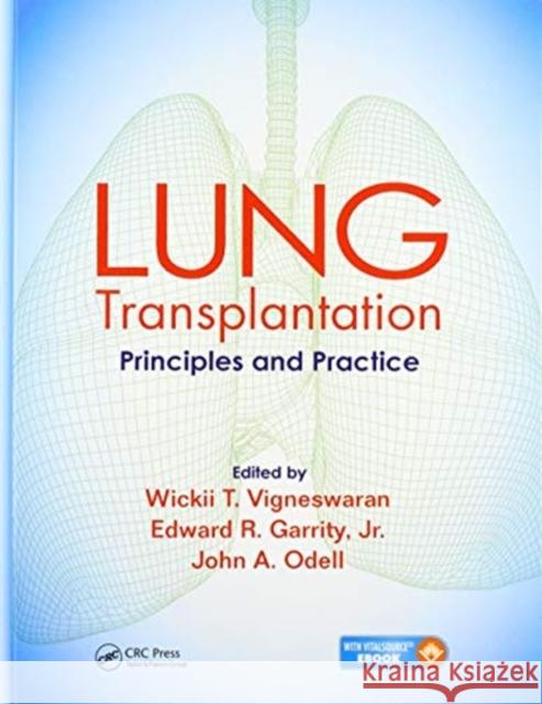 Lung Transplantation: Principles and Practice Wickii Vigneswaran Edward Garrity John Odell 9780367575120