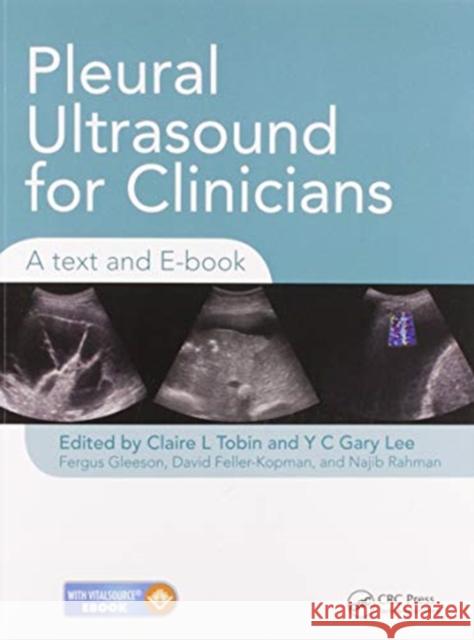 Pleural Ultrasound for Clinicians: A Text and E-Book Claire Tobin Y. C. Gary Lee Fergus Gleeson 9780367576158
