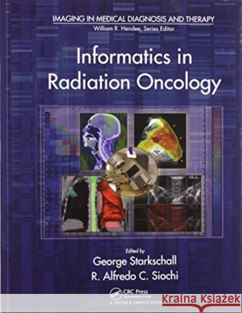 Informatics in Radiation Oncology George Starkschall R. Alfredo C. Siochi 9780367576332 CRC Press