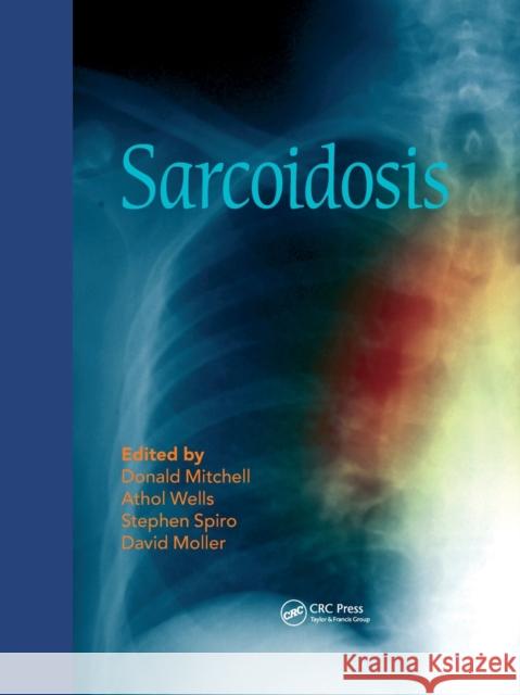 Sarcoidosis Donald Mitchell Athol Wells Stephen Spiro 9780367576769