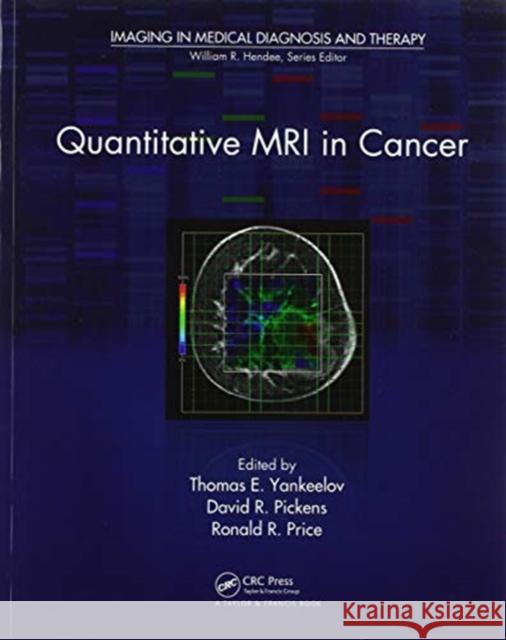 Quantitative MRI in Cancer Thomas E. Yankeelov David R. Pickens Ronald R. Price 9780367576875