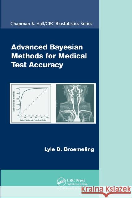 Advanced Bayesian Methods for Medical Test Accuracy Lyle D. Broemeling 9780367576905 CRC Press