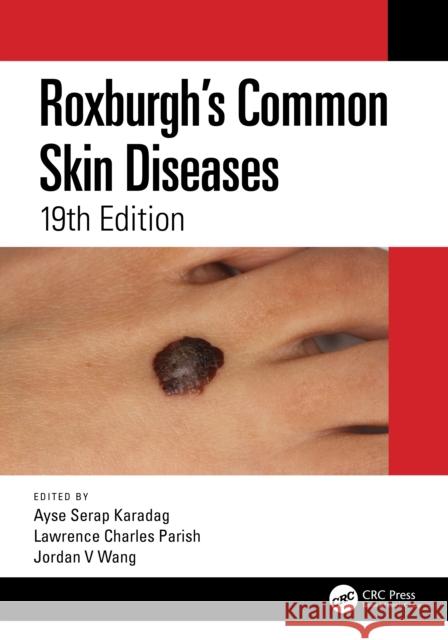 Roxburgh's Common Skin Diseases Ayse Serap Karadag Lawrence Charles Parish Jordan Wang 9780367614980 CRC Press