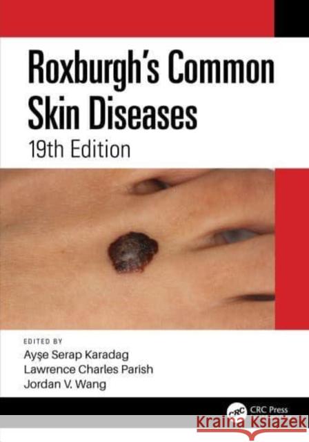 Roxburgh's Common Skin Diseases Ayse Serap Karadag Lawrence Charles Parish Jordan Wang 9780367614997 CRC Press