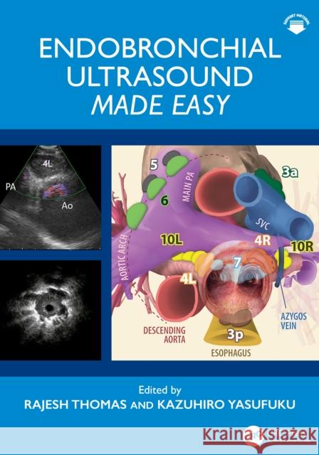 Endobronchial Ultrasound Bronchoscopy: Made Easy Rajesh Thomas Kazuhiro Yasufuku 9780367630768 CRC Press