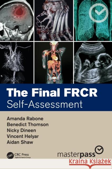 The Final Frcr: Self-Assessment Amanda Rabone Benedict Thomson Nicky Dineen 9780367637187 CRC Press