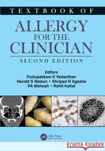 Textbook of Allergy for the Clinician  9780367642419 Taylor & Francis Ltd