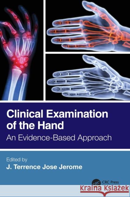 Clinical Examination of the Hand: An Evidence-Based Approach Jerome, J. Terrence Jose 9780367647186 CRC Press