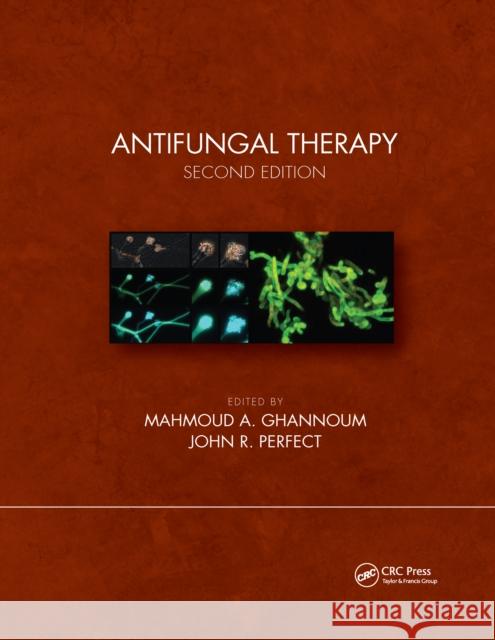 Antifungal Therapy Ghannoum, Mahmoud A. 9780367655945