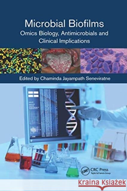 Microbial Biofilms: Omics Biology, Antimicrobials and Clinical Implications Chaminda Jayampath Seneviratne 9780367657994 CRC Press