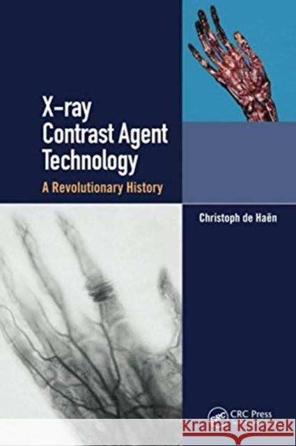 X-Ray Contrast Agent Technology: A Revolutionary History Christoph d 9780367730567 CRC Press