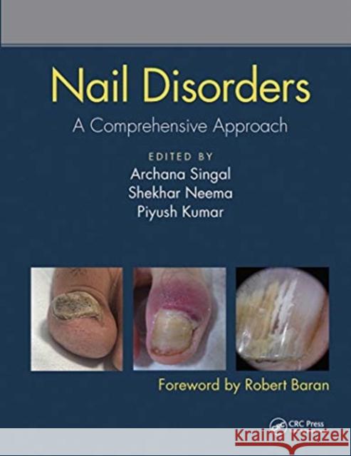 Nail Disorders: A Comprehensive Approach Archana Singal Shekhar Neema Piyush Kumar 9780367731717 CRC Press