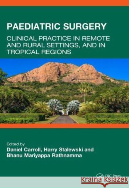 Paediatric Surgery: Clinical Practice in Remote and Rural Settings, and in Tropical Regions Daniel Carroll Harry Stalewski Bhanu Mariyappa Rathnamma 9780367742232 CRC Press