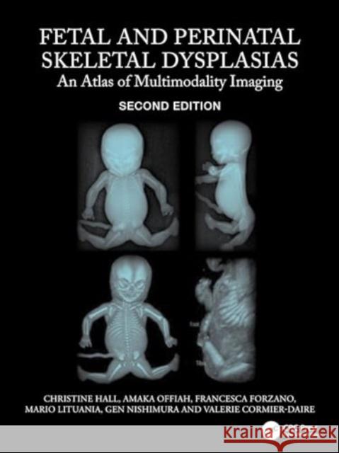 Fetal and Perinatal Skeletal Dysplasias: An Atlas of Multimodality Imaging Valerie Cormier-Daire 9780367764432 Taylor & Francis Ltd