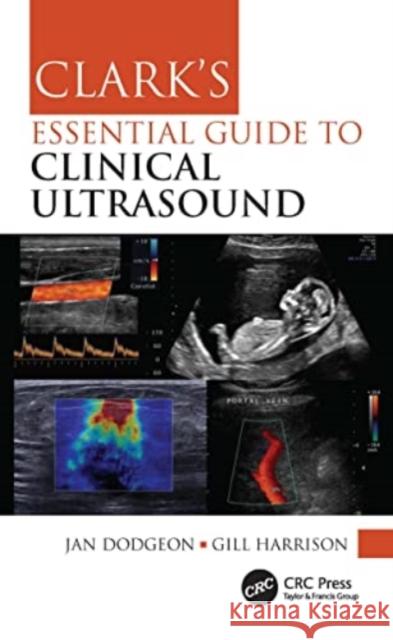 Clark's Essential Guide to Clinical Ultrasound Jan Dodgeon Gill Harrison 9780367771164