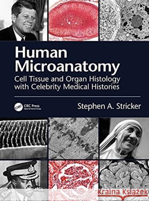 Human Microanatomy: Cell Tissue and Organ Histology with Celebrity Medical Histories Stricker, Stephen A. 9780367771843 CRC Press