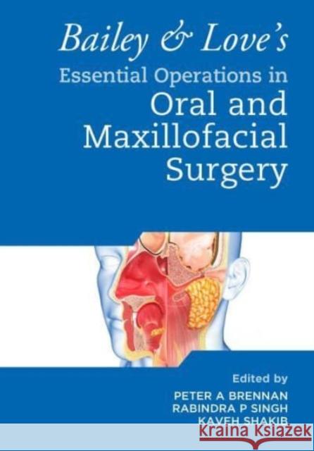 Bailey & Love\'s Essential Operations in Oral & Maxillofacial Surgery Peter A. Brennan Rabindra Singh Kaveh Shakib 9780367772581