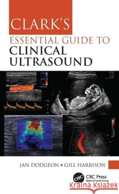 Clark's Essential Guide to Clinical Ultrasound Jan Dodgeon Gill Harrison 9780367775087