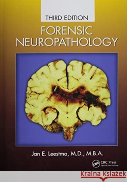 Forensic Neuropathology Jan E. Leestma 9780367777937 Taylor and Francis