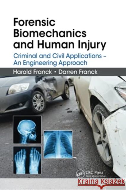 Forensic Biomechanics and Human Injury: Criminal and Civil Applications - An Engineering Approach Harold Franck Darren Franck 9780367778866 CRC Press