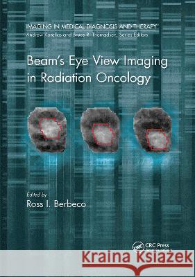 Beam's Eye View Imaging in Radiation Oncology  9780367781934 Taylor and Francis