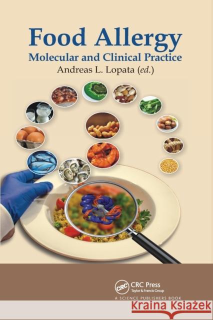 Food Allergy: Molecular and Clinical Practice Andreas L. Lopata 9780367781996 CRC Press