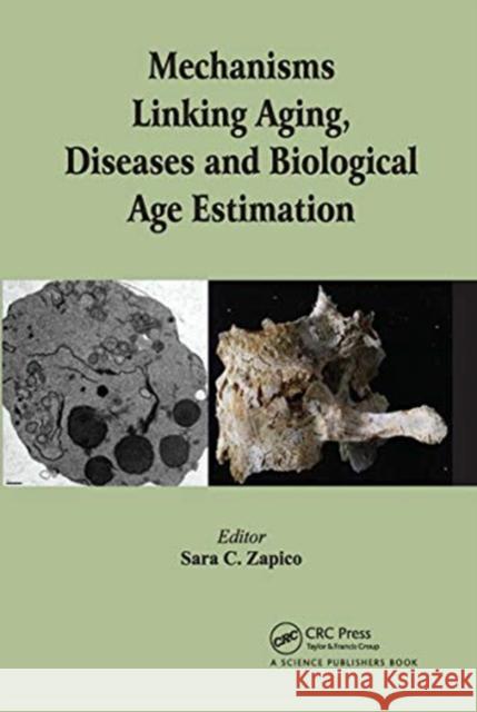 Mechanisms Linking Aging, Diseases and Biological Age Estimation  9780367782429 Taylor and Francis
