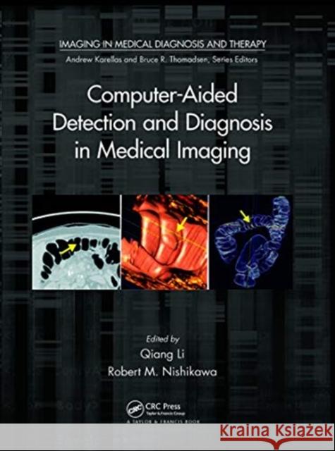 Computer-Aided Detection and Diagnosis in Medical Imaging Qiang Li Robert M. Nishikawa 9780367783556 CRC Press