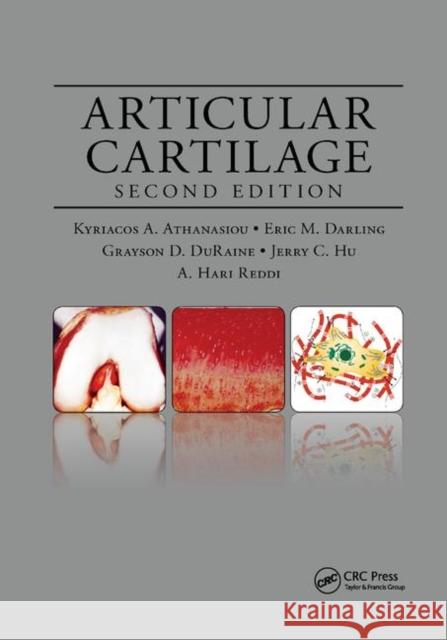 Articular Cartilage Kyriacos a. Athanasiou Eric M. Darling Jerry C. Hu 9780367871802 CRC Press